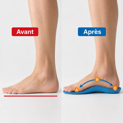 OrthoStep™ – Semelles Orthopédiques Anti-Fasciite Plantaire