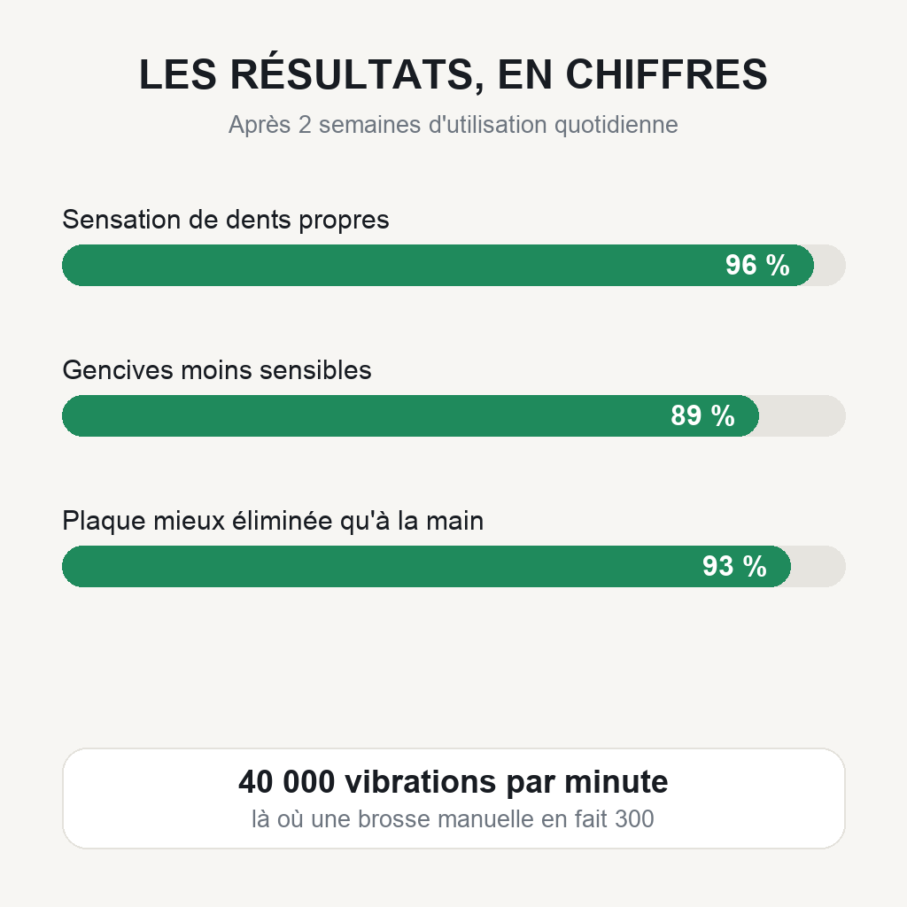 sec_brosse_stats